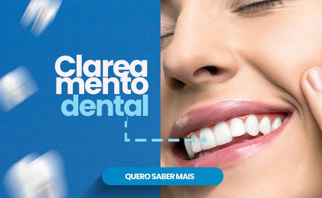 Clareamento Dental