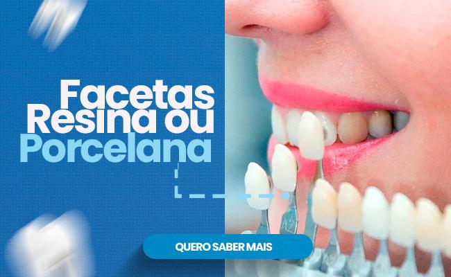 Facetas em Resina ou Porcelana 