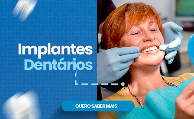 Implantes Dentários 